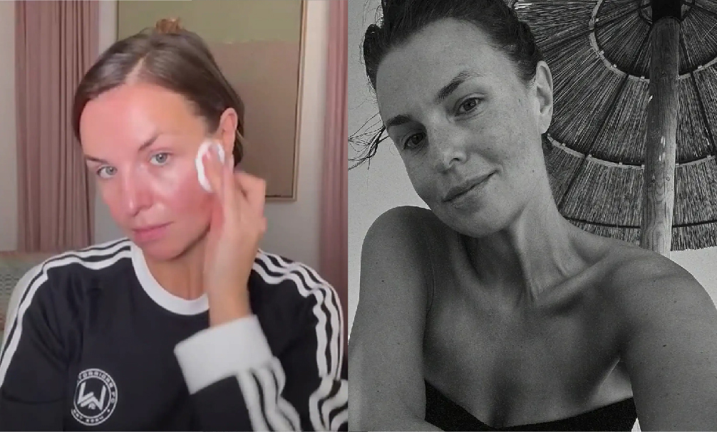 Laura Wontorra Ungeschminkt: So zeigt sich die Moderatorin ganz natürlich